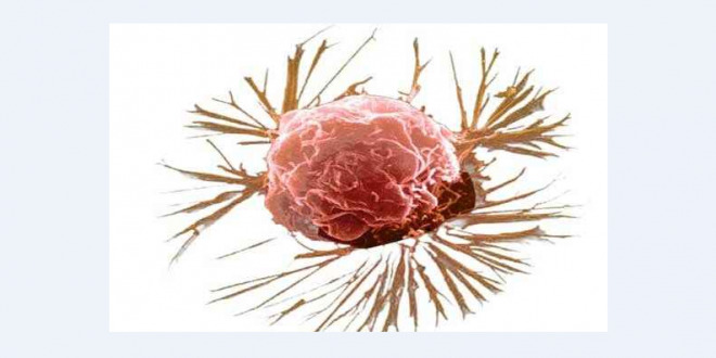 علائم و راه های تشخیص سرطان سینه